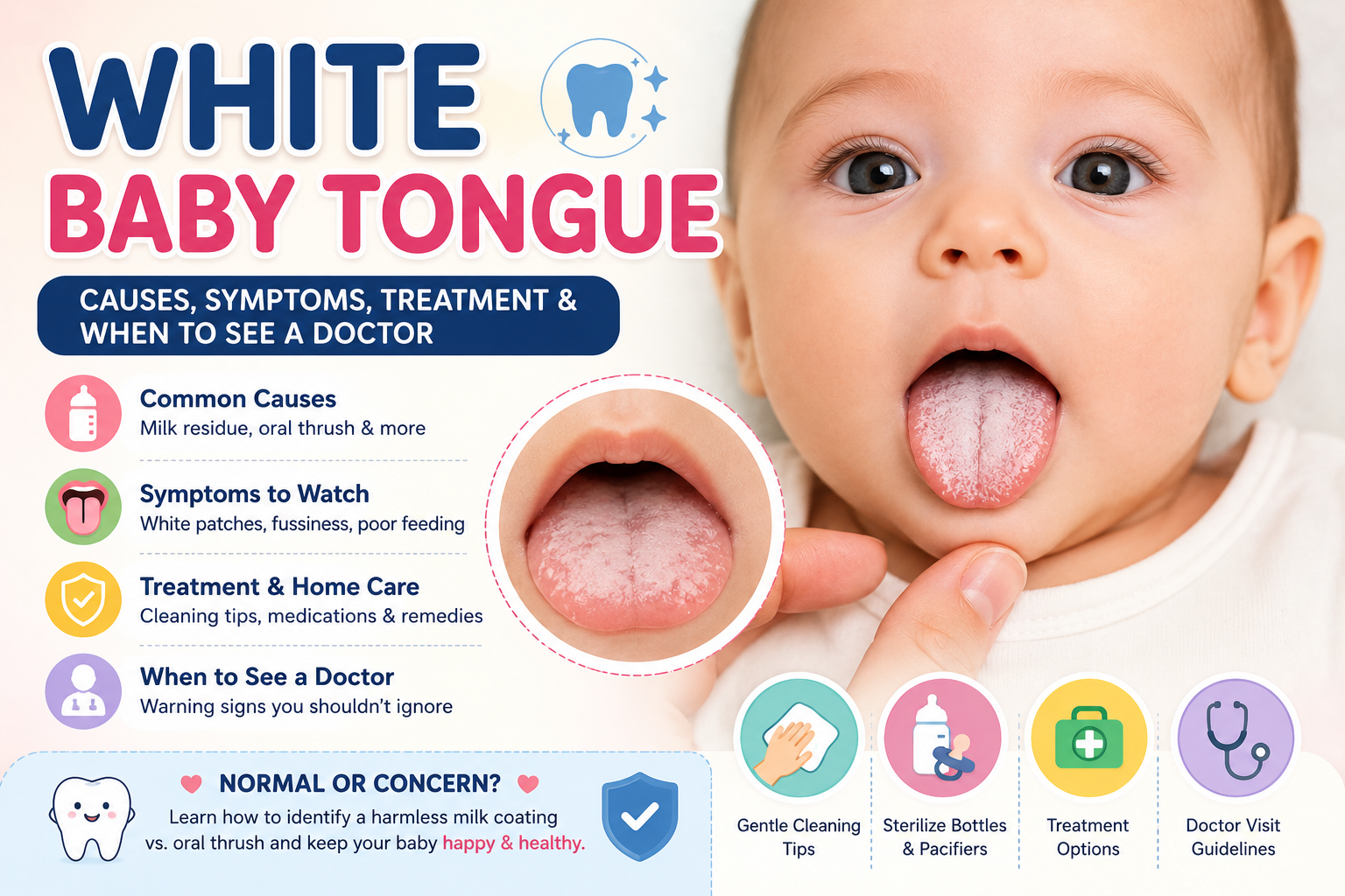 White baby tongue infographic explaining the causes of a white-coated tongue in infants, symptoms of oral thrush, treatment options, oral hygiene tips, and when to see a doctor.
