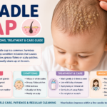 Cradle cap infographic explaining the causes of yellow flaky scalp in babies, common symptoms, safe treatment, home care tips, and when parents should see a doctor.