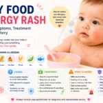 Baby food allergy rash infographic showing common food allergens, hives, skin rash symptoms, treatment tips, and emergency warning signs in babies.