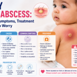 Baby skin abscess infographic showing a red swollen lump, symptoms, bacterial infection causes, treatment options, home care tips, and warning signs.